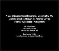 A Case of Levonorgestrel Intrauterine System (LNG-IUS) String Fistulization Through the Anterior Cer
