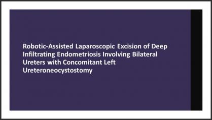 ROBOTIC-ASSISTED LAPAROSCOPIC EXCISION OF DEEP INFILTRATING ENDOMETRIOSIS INVOLVING THE LEFT URETER 