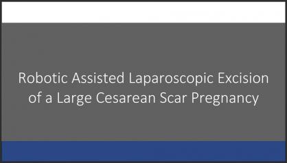 ROBOTIC-ASSISTED LAPAROSCOPIC EXCISION OF A LARGE CESAREAN SCAR PREGNANCY