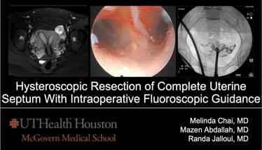 Hysteroscopic Resection of Complete Uterine Septum with Intraoperative Fluoroscopic Guidance