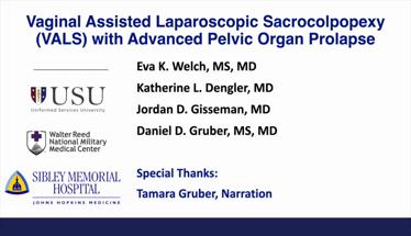 Vaginal Assisted Laparoscopic Sacrocolpopexy (VALS) for Gals with Advanced Pelvic Organ Prolapse