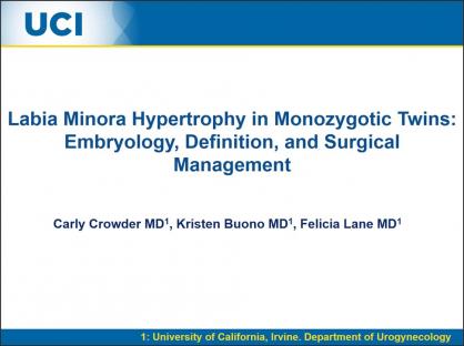 Labia Minora Hypertrophy in Monozygotic Twins: Embryology, Definition, and Surgical Management