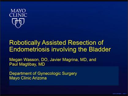 ROBOTICALLY ASSISTED RESECTION OF ENDOMETRIOSIS INVOLVING THE BLADDER