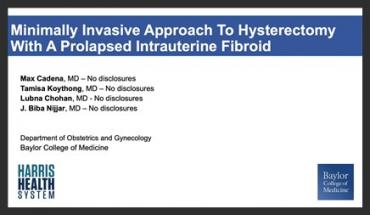 MINIMALLY INVASIVE APPROACH TO HYSTERECTOMY WITH A PROLAPSED INTRAUTERINE FIBROID