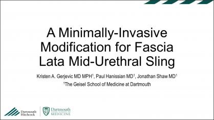 A MINIMALLY-INVASIVE MODIFICATION FOR FASCIA LATA MID-URETHRAL SLING