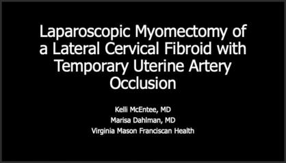 LAPAROSCOPIC MYOMECTOMY OF A LATERAL CERVICAL FIBROID WITH TEMPORARY UTERINE ARTERY OCCLUSION