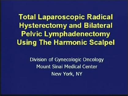 Total Laparoscopic Radical Hysterectomy and Bilateral Pelvic Lymphadenectomy Using The Harmonic Scal