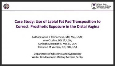 Case Study: Use of Labial Fat Pad Transposition to Correct Prosthetic Exposure in the Distal Vagina