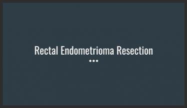 Rectal Endometrioma Resection