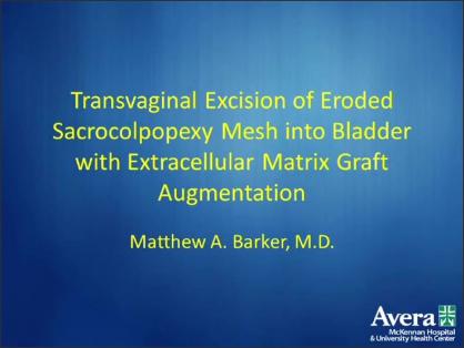 TRANSVAGINAL EXCISION OF ERODED SACROCOLPOPEXY MESH INTO BLADDER WITH EXTRACELLULAR MATRIX GRAFT AUG
