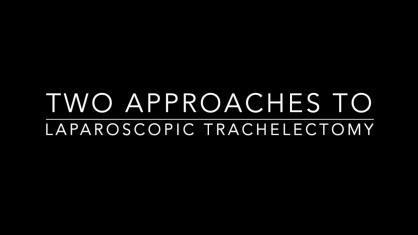 Two Approaches To Laparoscopic Trachelectomy