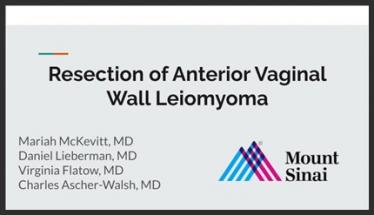 Resection of Anterior Vaginal Wall Leiomyoma