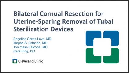 BILATERAL CORNUAL RESECTION FOR UTERINE-SPARING REMOVAL OF TUBAL STERILIZATION DEVICES