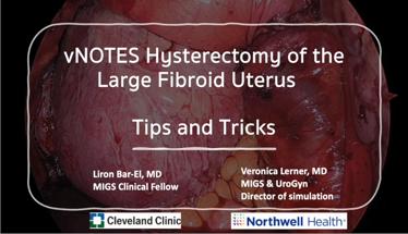 vNOTES Hysterectomy of the Large Fibroid Uterus - Tips and Tricks