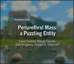PERIURETHRAL MASS: A PUZZLING ENITITY