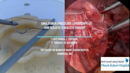 SIMULATION IN GYNECOLOGIC LAPAROSCOPY: HOW REALISTIC IS REALISTIC ENOUGH?