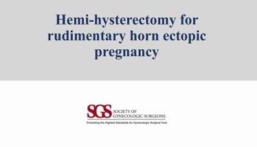 Hemi-Hysterectomy for Rudimentary Horn Ectopic Pregnancy