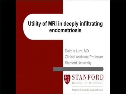 UTILITY OF MRI IN DEEPLY INFILTRATING ENDOMETRIOSIS