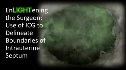 EnLIGHTening the Surgeon: Use of ICG to Delineate Boundaries of an Intrauterine Septum