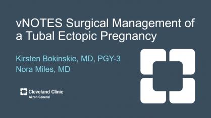 vNOTES Surgical Management of a Tubal Ectopic Pregnancy