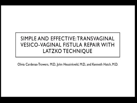 SIMPLE AND EFFECTIVE: TRANSVAGINAL VESICO-VAGINAL FISTULA REPAIR WITH LATZKO TECHNIQUE