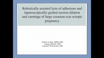 ROBOTICALLY-ASSISTED LYSIS OF ADHESIONS & SUCTION D&C FOR MANAGEMENT OF C-SECTION SCAR ECTOPIC PREGN