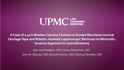 A Case of a 4cm Calculi Formed on Eroded Mersilene Cervical Cerclage Tape & Robotic-Assisted Lap..