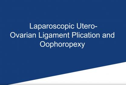 Laparoscopic Utero-Ovarian Ligament Plication and Oophoropexy for Recurrent Adnexal Torsion