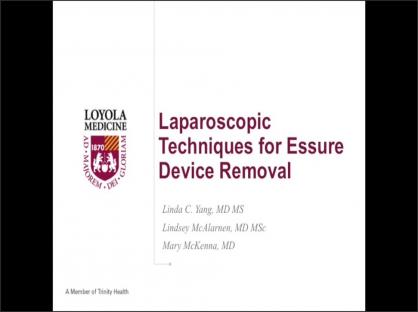 Laparoscopic Techniques for Essure Device Removal