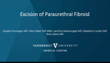 Excision of Paraurethral Fibroid