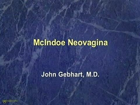 McIndoe Neovagina for Vaginal Agenesis