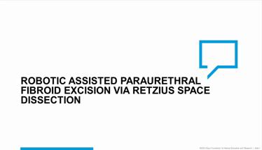 Robotic Assisted Paraurethral Fibroid Excision via Retzius Space Dissection