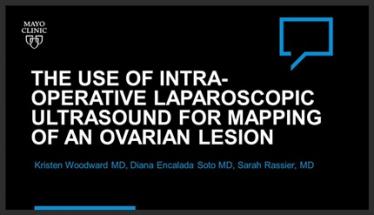 The Use of Intra-Operative Laparoscopic Ultrasound for Mapping of an Ovarian Lesion