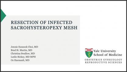 RESECTION OF INFECTED SACROHYSTEROPEXY MESH
