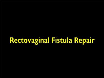 RECTOVAGINAL FISTULA REPAIR