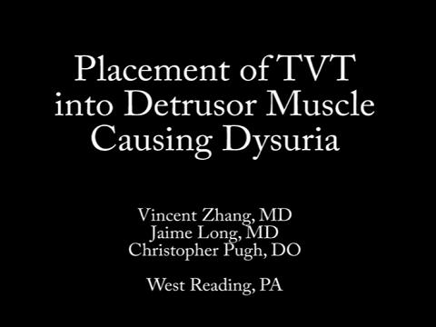 PLACEMENT OF TVT INTO DETRUSOR MUSCLE CAUSING DYSURIA