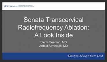 SONATA TRANSCERVICAL RADIOFREQUENCY ABLATION: A LOOK INSIDE