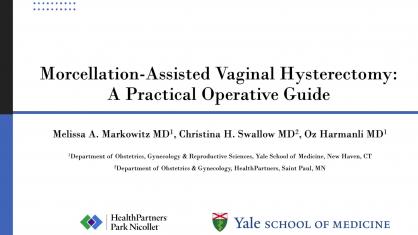Morcellation-Assisted Vaginal Hysterectomy: A Practical Operative Guide