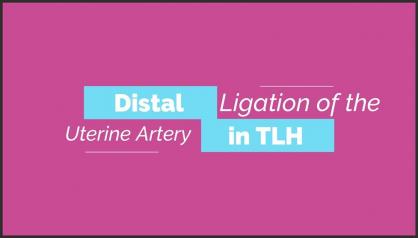 DISTAL LIGATION OF THE UTERINE ARTERY IN TLH