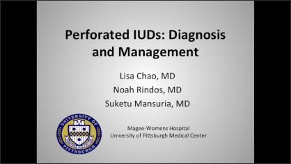 Perforated IUDs: Diagnosis and Management