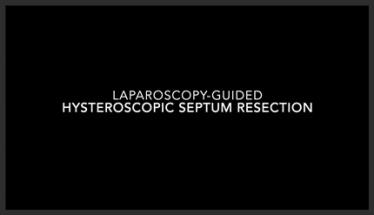 Laparoscopic-guided Hysteroscopic Septum Resection