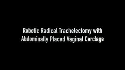 ROBOTIC RADICAL TRACHELECTOMY WITH ABDOMINALLY PLACED VAGINAL CERCLAGE
