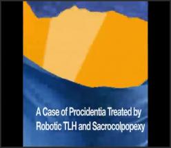 A CASE OF PROCIDENTIA TREATED BY ROBOTIC ASSISTED TOTAL HYSTERECTOMY AND SACROCOLPOPEXY