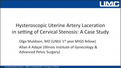 HYSTEROSCOPIC UTERINE ARTERY LACERATION IN SETTING OF CERVICAL STENOSIS: A CASE STUDY