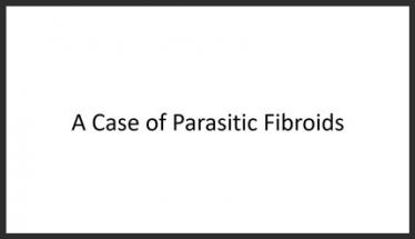 A Case of Parasitic Fibroids