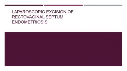Laparoscopic Excision of Rectovaginal Septum Endometriosis