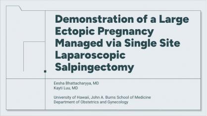 Demonstration of a Large Ectopic Pregnancy Managed via Single Site Laparoscopic Salpingectomy