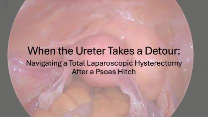When the Ureter Takes a Detour: Navigating a Total Laparoscopic Hysterectomy After a Psoas Hitch