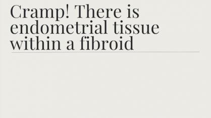 Cramp! There Is Endometrial Tissue Within a Fibroid