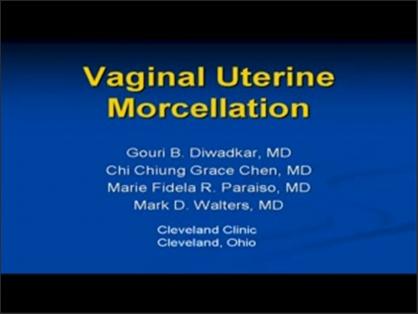 Vaginal Uterine Morcellation